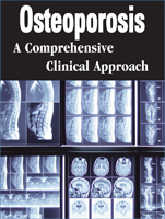 Osteoporosis Live On-Site Seminars